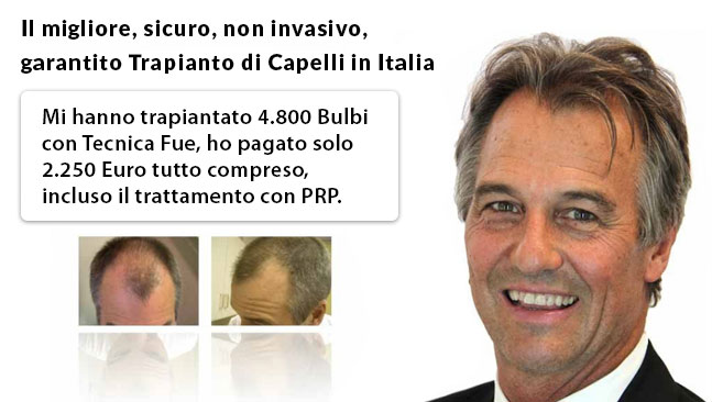 Clinica trapianto capelli